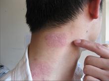 ţƤѢ֢״ºÍÕï¶Ï°ì·¨