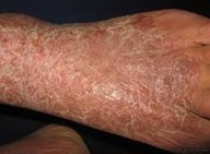 ÂýÐÔʪÕîµÄͼƬ