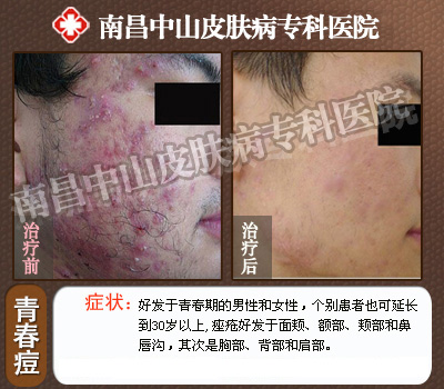 �ҵ��ഺ����Ȼ����