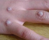 Ѱ³£ðàÓÐÄÄЩ±íÏÖ¼°ÈçºÎÕï¶Ï£¿