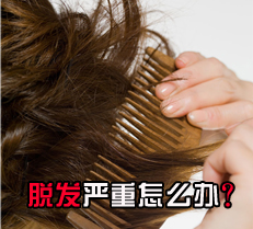 脱发严重怎么办