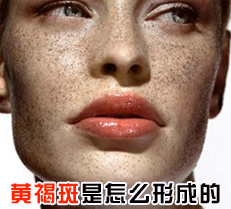 �ƺְ�����ô�γɵ�