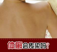 体癣会传染吗