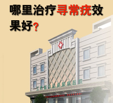 哪里治疗寻常疣效果好