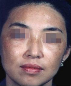 �����ƺְߵ�Σ��