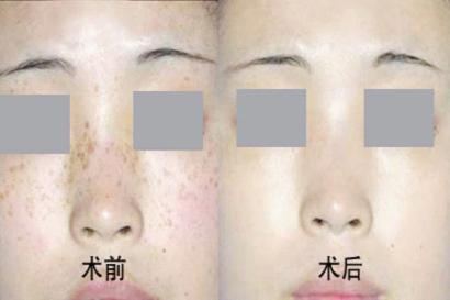 ����ȥ���ƺְߵķ���