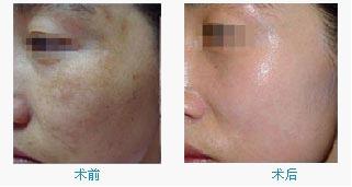 �ƺְ�������Ʒ���