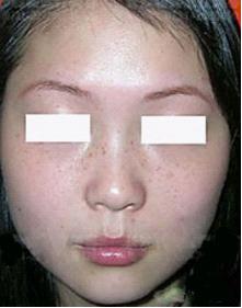 ���ٻƺְߵķ���