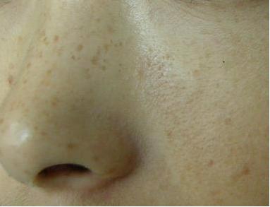 �ƺְ����Ʒ���