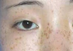 �ƺְ��Ŵ���