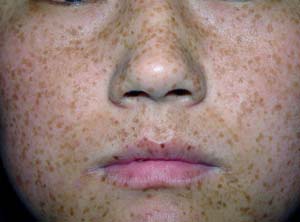 �ƺְ���״��ʲô