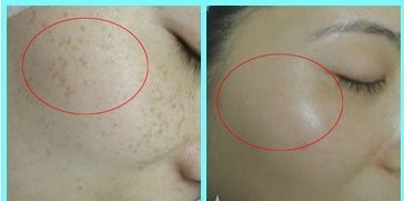 �ƺְ��Ƴ̼���