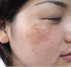 �ƺְߵ��γ�ԭ��