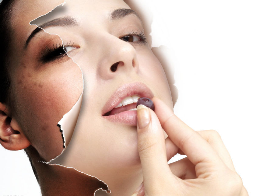 黄褐斑形成的原因