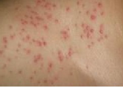 ëÄÒÑ×ÊÇÔõôÒýÆðµÄ