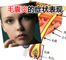 毛囊炎的症状