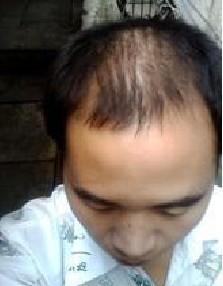 ÈçºÎÖÎÁÆÖ¬ÒçÐÔÍÑ·¢