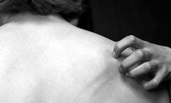 Ƥ·ôðþÑ÷²¡Òò