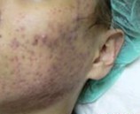 Çà´º¶»ÔõôÖÎÁƲÅ×îºÃ