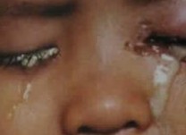 什么是淋病性结膜炎