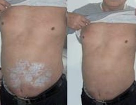 �ϲ��ļ�ҽԺţƤѢ���