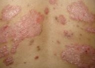 ϲţƤѢҽԺļұȽϺ