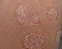 ϲȽϺõţƤѢţƤѢҽԺ