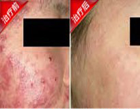 ðî´¯ÖÎÁÆÇ°ºó¶Ô±È