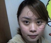 化妆品过敏症状