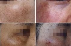 �ƺְߵļ��ֳ���֢״����