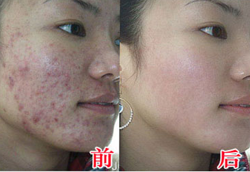 南昌中山皮肤病医院