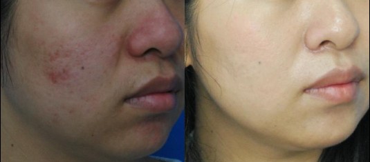 ÄϲýÖÐɽƤ·ô²¡Ò½Ôº