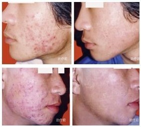 ÄϲýÖÐɽƤ·ô²¡Ò½Ôº