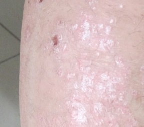 南昌中山皮肤病医院