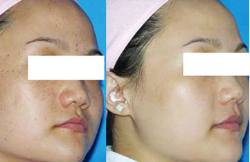 南昌中山皮肤病医院