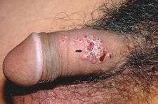 上海最好的皮肤病医院