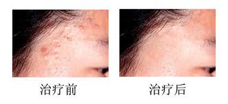 上海最好的皮肤病医院 上海江中医院