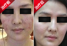 上海最好的皮肤病医院 上海江中医院