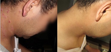 上海最好的皮肤病医院 上海江中医院