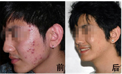 ÄϲýÖÐɽƤ·ô²¡Ò½Ôº