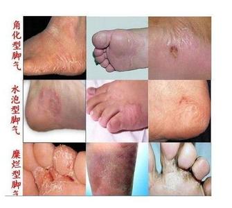 南昌中山皮肤专科医院